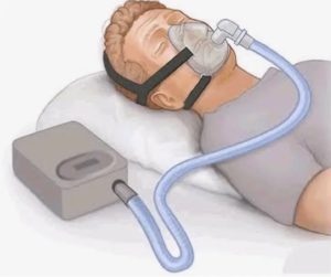 СИПАП аппарат с маской и шлангом