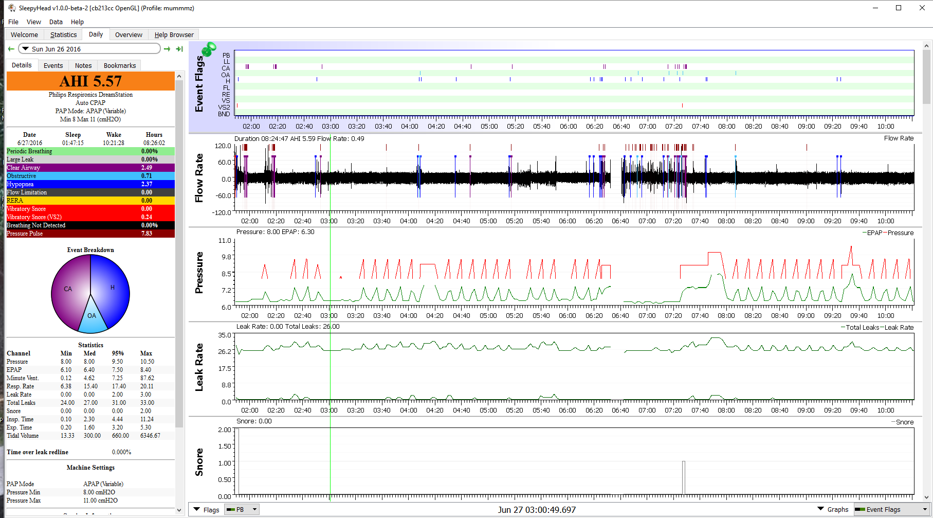 SleepyHead приложение анализа данных СИПАП